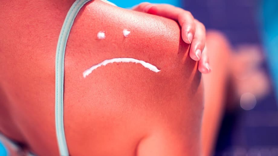 “After Sun” : pourquoi et comment réparer votre peau après l’été ?