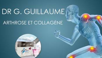 La maladie de l’arthrose et le rôle du collagène : Interview Rhumatologue 